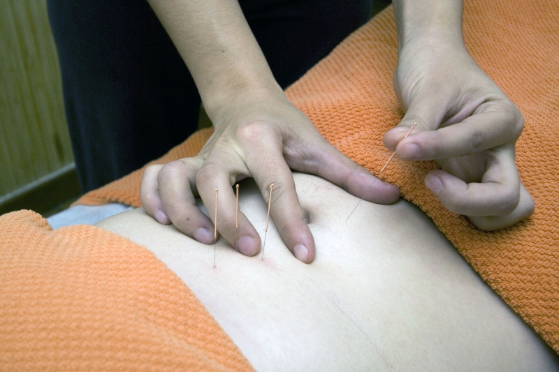 osteopathe-LA VALETTE DU VAR-min_acupuncture-4175625